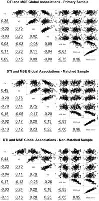 The Relation Between White Matter Microstructure and Network Complexity: Implications for Processing Efficiency